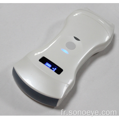 Scanner à ultrasons sans fil de néphrologie